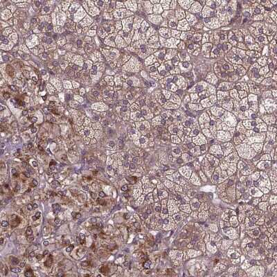 Immunohistochemistry: ZNF616 Antibody [NBP2-49662] - Staining of human adrenal gland shows cytoplasmic positivity in glandular cells.