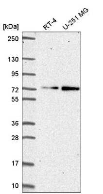 Western Blot: ZNF616 Antibody [NBP2-57531] - Western blot analysis in human cell line RT-4 and human cell line U-251 MG.