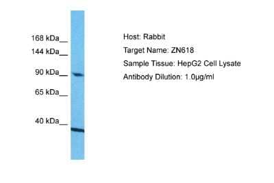 Western Blot: ZNF618 Antibody [NBP2-88716] - Host: Rabbit. Target Name: ZN618. Sample Type: HepG2 Whole Cell lysates. Antibody Dilution: 1.0ug/ml