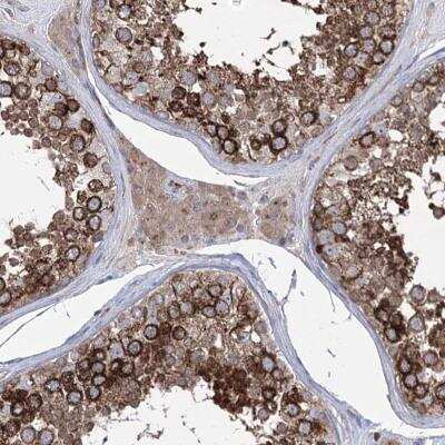 Immunohistochemistry: ZNF622 Antibody [NBP1-81183] - Staining of human testis shows cytoplasmic positivity in cells in seminiferous ducts and Leydig cells.