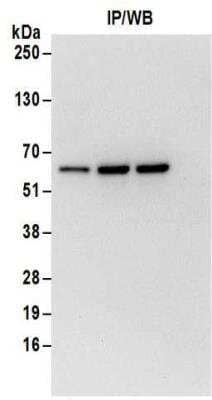 <b>Biological Strategies Validation. </b>Immunoprecipitation: ZNF622 Antibody [NBP2-32087] - Samples:  Whole cell lysate (1 mg for IP; 20% of IP loaded) from HeLa cells.  Antibodies:  Affinity purified rabbit anti-ZNF622 antibody NBP2-32087 used for IP at 6 ug/mg lysate.  For blotting immunoprecipitated ZNF622, NBP2-32087 was used at 0.4 ug/ml.  Detection: Chemiluminescence with an exposure time of 10 seconds.