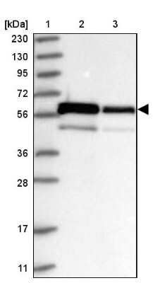 Western Blot: ZNF622 Antibody [NBP1-81183] - Lane 1: Marker  [kDa] 230, 130, 95, 72, 56, 36, 28, 17, 11.  Lane 2: Human cell line RT-4.  Lane 3: Human cell line U-251MG sp