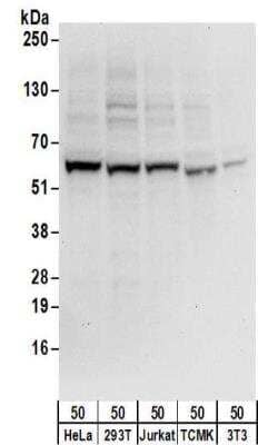 Western Blot: ZNF622 Antibody [NBP2-32087] - Samples:  Whole cell lysate (50 ug) from HeLa, 293T, Jurkat, mouse TCMK-1, and mouse NIH3T3 cells. Antibodies:  Affinity purified rabbit anti-ZNF622 antibody NBP2-32087 used for WB at 0.4 ug/ml.  Detection: Chemiluminescence with an exposure time of 10 seconds.