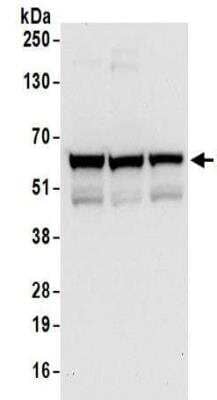 <b>Independent Antibodies Validation and Biological Strategies Validation.</b>Western Blot: ZNF622 Antibody [NBP2-32102] - Whole cell lysate (50 ug) from HeLa, 293T, and Jurkat cells.  Antibodies:  Affinity purified rabbit anti-ZPR9 antibody NBP2-32102 used for WB at 0.1 ug/ml.  Detection: Chemiluminescence with an exposure time of 10 seconds.