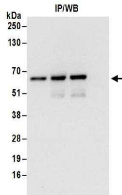 Western Blot: ZNF622 Antibody [NBP2-32102] - Western Blot: ZNF622 Antibody [NBP2-32102] - Whole cell lysate (1 mg for IP; 20% of IP loaded) from HeLa cells.  Antibodies:  Affinity purified rabbit anti-ZPR9 antibody NBP2-32102 used for IP at 6 ug/mg lysate.  ZPR9 was also immunoprecipitated by rabbit anti-ZPR9 antibodies NBP2-32087 and NBP2-32103.  For blotting immunoprecipitated ZPR9, NBP2-32102was used at 0.1 ug/ml.  Detection: Chemiluminescence with an exposure time of 10 seconds.