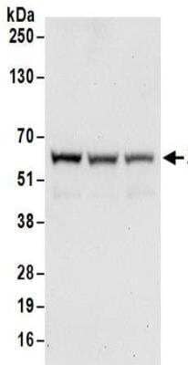 <b>Independent Antibodies Validation and Biological Strategies Validation.</b>Western Blot: ZNF622 Antibody [NBP2-32103] - Whole cell lysate (50 ug) from HeLa, 293T, and Jurkat cells.  Antibodies:  Affinity purified rabbit anti-ZPR9 antibody NBP2-32103 used for WB at 0.1 ug/ml.  Detection: Chemiluminescence with an exposure time of 30 seconds.
