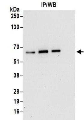 Western Blot: ZNF622 Antibody [NBP2-32103] - Western Blot: ZNF622 Antibody [NBP2-32103] - Whole cell lysate (1 mg for IP; 20% of IP loaded) from HeLa cells.  Antibodies:  Affinity purified rabbit anti-ZPR9 antibody NBP2-32103 used for IP at 6 ug/mg lysate.  ZPR9 was also immunoprecipitated by rabbit anti-ZPR9 antibodies NBP2-32087 and NBP2-32102.  For blotting immunoprecipitated ZPR9, NBP2-32103 was used at 0.1 ug/ml.  Detection: Chemiluminescence with an exposure time of 30 seconds.
