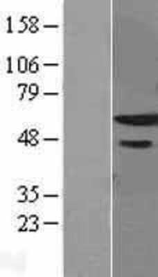Western Blot: ZNF622 Overexpression Lysate (Adult Normal) [NBL1-18211] Left-Empty vector transfected control cell lysate (HEK293 cell lysate); Right -Over-expression Lysate for ZNF622.