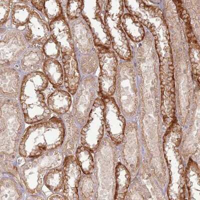 Immunohistochemistry-Paraffin: ZNF623 Antibody [NBP1-92637] - Staining of human kidney shows distinct cytoplasmic positivity in distal tubules.