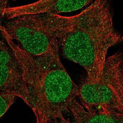 Immunocytochemistry/Immunofluorescence: ZNF626 Antibody [NBP2-13588] - Staining of human cell line SK-MEL-30 shows localization to nucleoplasm, nuclear membrane & vesicles.