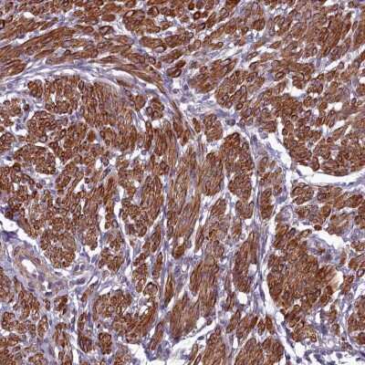 Immunohistochemistry-Paraffin: ZNF626 Antibody [NBP2-13588] - Staining of human smooth muscle shows cytoplasmic positivity in smooth muscle cells.