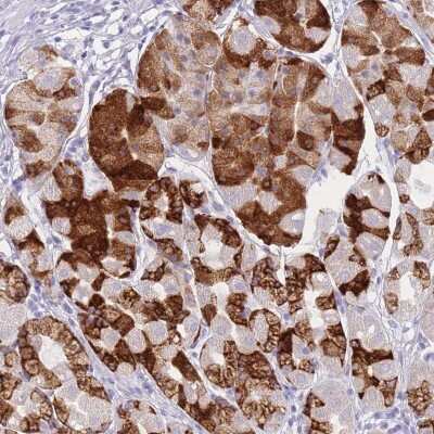 Immunohistochemistry-Paraffin ZNF627 Antibody - BSA Free