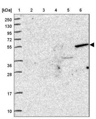 Western Blot ZNF627 Antibody - BSA Free