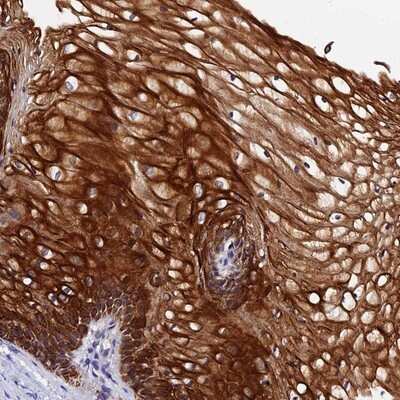 Immunohistochemistry-Paraffin: ZNF628 Antibody [NBP1-92638] - Staining of human vagina shows strong cytoplasmic and membranous positivity in squamous epithelial cells.