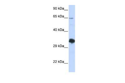 Western Blot: ZNF630 Antibody [NBP2-86539] - WB Suggested Anti-ZNF630 Antibody Titration: 0.2-1 ug/ml. ELISA Titer: 1:312500. Positive Control: 293T cell lysate