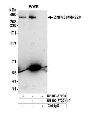 Immunoprecipitation ZNF638 Antibody