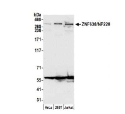 Western Blot ZNF638 Antibody