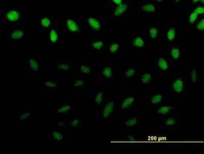 Immunocytochemistry/Immunofluorescence: ZNF643 Antibody [H00065243-B01P] - Analysis of purified antibody to ZNF643 on HeLa cell. (antibody concentration 10 ug/ml)