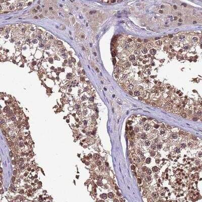 Immunohistochemistry-Paraffin: ZNF643 Antibody [NBP1-92639] - Staining of human testis shows moderate cytoplasmic and nuclear positivity in cells in seminiferus ducts.
