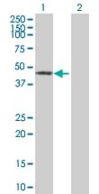 Western Blot: ZNF643 Antibody [H00065243-B01P] - Analysis of ZNF643 expression in transfected 293T cell line by ZNF643 polyclonal antibody.  Lane 1: ZNF643 transfected lysate(47.52 KDa). Lane 2: Non-transfected lysate.