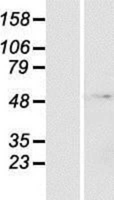 Western Blot: ZNF643 Overexpression Lysate (Adult Normal) [NBP2-06385] Left-Empty vector transfected control cell lysate (HEK293 cell lysate); Right -Over-expression Lysate for ZNF643.