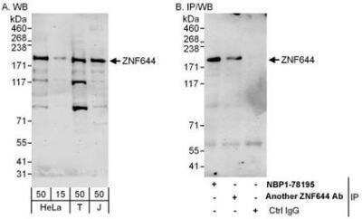 Western Blot: ZNF644 Antibody [NBP1-78195] - Whole cell lysate from 293T (15 and 50 mcg for WB; 1 mg for IP, 20% of IP loaded), Jurkat (J; 50 mcg) and HeLa (H; 50 mcg) cells.Affinity purified rabbit anti-ZNF644 antibody  used for WB at 0.4 mcg/ml (A) and 1 mcg/ml (B) and used for IP at 6 mcg/mg lysate.  ZNF644 was also immunoprecipitated by another rabbit anti-ZNF644 antibody  which recognizes a downstream epitope.