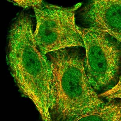 Immunocytochemistry/Immunofluorescence: ZNF646 Antibody [NBP1-81522] - Immunofluorescent staining of human cell line A549 shows localization to nucleoplasm, plasma membrane & cytosol.