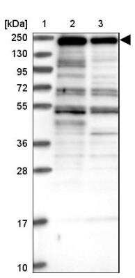 Western Blot: ZNF646 Antibody [NBP1-81522] - Lane 1: Marker  [kDa] 250, 130, 95, 72, 55, 36, 28, 17, 10.  Lane 2: Human cell line RT-4.  Lane 3: Human cell line U-251MG sp