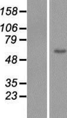Western Blot: ZNF649 Overexpression Lysate (Adult Normal) [NBP2-06388] Left-Empty vector transfected control cell lysate (HEK293 cell lysate); Right -Over-expression Lysate for ZNF649.