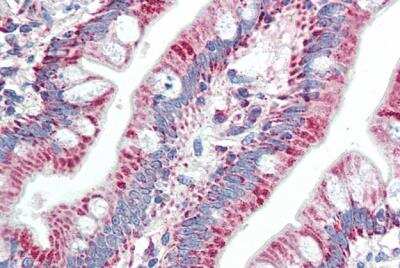 Immunohistochemistry-Paraffin ZNF652 Antibody