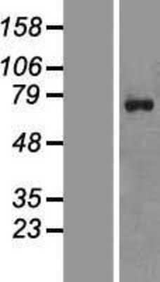 Western Blot ZNF652 Overexpression Lysate