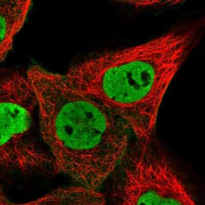 Immunocytochemistry/Immunofluorescence: ZNF655 Antibody [NBP1-80625] - Staining of human cell line A-431 shows localization to nucleoplasm & plasma membrane. Antibody staining is shown in green.