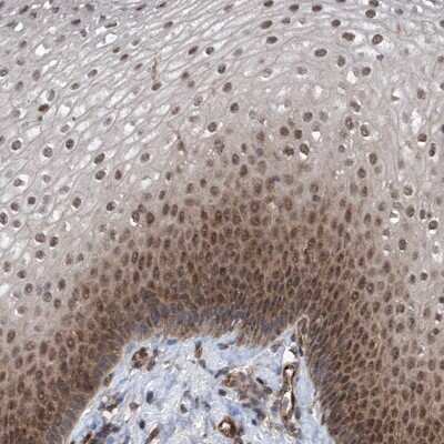 Immunohistochemistry-Paraffin: ZNF655 Antibody [NBP1-80625] - Staining of human esophagus shows nuclear and cytoplasmic positivity in squamous epithelial cells.