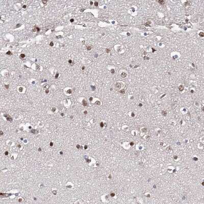 Immunohistochemistry-Paraffin: ZNF655 Antibody [NBP1-80625] - Staining of human cerebral cortex shows strong nuclear positivity in glial cells and neurons.