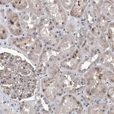 Immunohistochemistry-Paraffin: ZNF655 Antibody [NBP1-80625] - Staining of human kidney shows moderate nuclear positivity in cells in tubules.