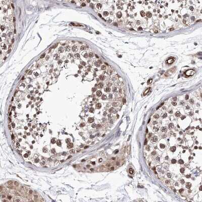Immunohistochemistry-Paraffin: ZNF655 Antibody [NBP1-80625] - Staining of human testis shows strong nuclear positivity in cells in seminiferous ducts.