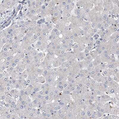 Immunohistochemistry-Paraffin: ZNF655 Antibody [NBP1-80625] - Staining of human liver shows no positivity in hepatocytes as expected.