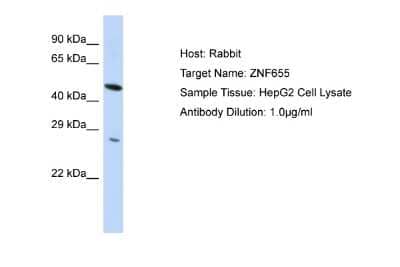 Western Blot: ZNF655 Antibody [NBP2-88718] - Host: Rabbit. Target Name: ZNF655. Sample Type: HepG2 Whole Cell lysates. Antibody Dilution: 1.0ug/ml