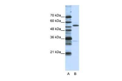 Western Blot: ZNF655 Antibody [NBP2-88720] - WB Suggested Anti-ZNF655 Antibody Titration: 1.25ug/ml. Positive Control: HepG2 cell lysate