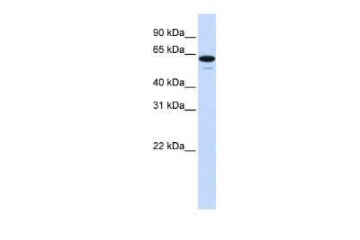 Western Blot: ZNF655 Antibody [NBP2-88721] - WB Suggested Anti-ZNF655 Antibody Titration: 0.2-1 ug/ml. ELISA Titer: 1:62500. Positive Control: Human brain