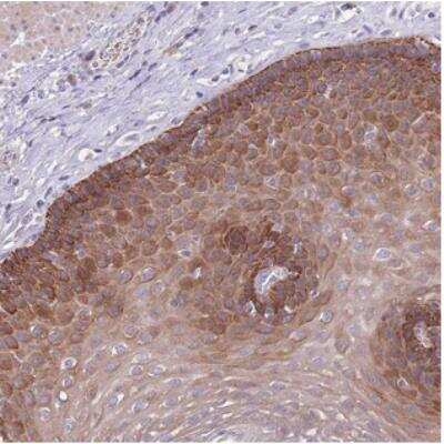 Immunohistochemistry: ZNF658 Antibody [NBP2-30748] - Staining of human esophagus shows strong cytoplasmic positivity in squamous epithelial cells.