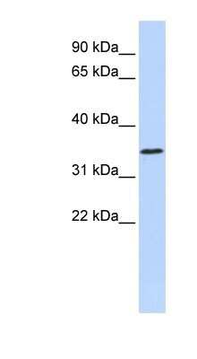 Western Blot: ZNF660 Antibody [NBP1-80189] - Hela cell lysate, concentration 0.2-1 ug/ml.