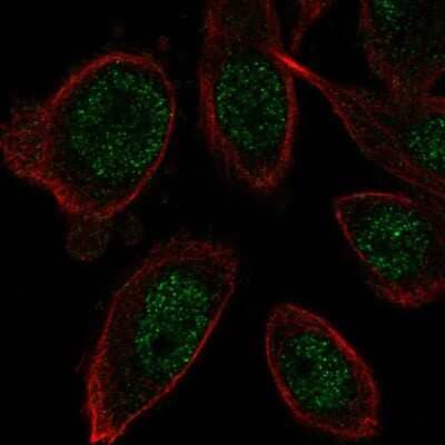 Immunocytochemistry/ Immunofluorescence ZNF664 Antibody - BSA Free