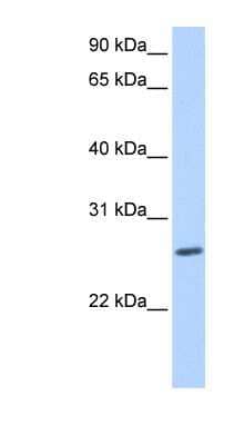 Western Blot ZNF664 Antibody - BSA Free