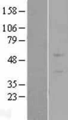 Western Blot: ZNF669 Overexpression Lysate (Adult Normal) [NBL1-18220] Left-Empty vector transfected control cell lysate (HEK293 cell lysate); Right -Over-expression Lysate for ZNF669.