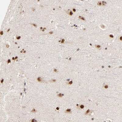 Immunohistochemistry-Paraffin: ZNF670 Antibody [NBP1-81218] - Staining of human cerebral cortex shows strong nuclear positivity in neuronal cells and glial cells.
