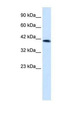 Western Blot: ZNF670 Antibody [NBP1-80131] - HepG2 cell lysate, concentration 1.25ug/ml.