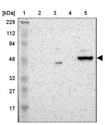 Western Blot: ZNF670 Antibody [NBP1-81218] - Lane 1: Marker [kDa] 229, 112, 84, 48, 32, 27, 17Lane 2: Human cell line RT-4Lane 3: Human cell line U-251MG spLane 4: Human plasma (IgG/HSA depleted)Lane 5: Human liver tissue