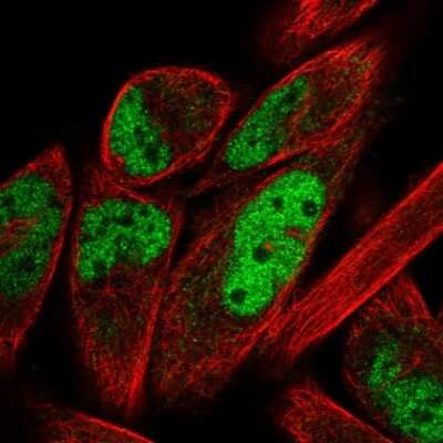 Immunocytochemistry/ Immunofluorescence ZNF671 Antibody