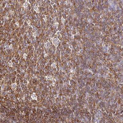 Immunohistochemistry-Paraffin ZNF671 Antibody